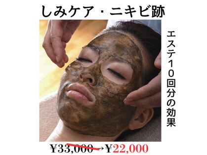 アルルプラス 山科(ARuru+)の写真