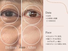 ヨサパーク すずのね(YOSA PARK)/水素吸入後の変化