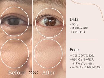 ヨサパーク すずのね(YOSA PARK)/水素吸入後の変化