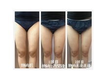 ピピランチェ ベッカン(PIPIRANCHE bekkan)