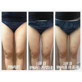 ピピランチェ ベッカン(PIPIRANCHE bekkan)