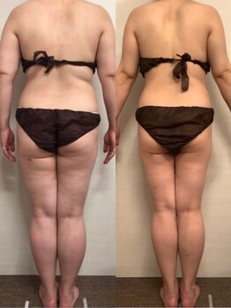 ジュメル 恵比寿店(Jumelles)/全身施術