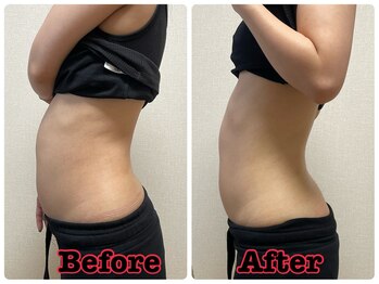 メリンダ(Merinda)/ポッコリお腹