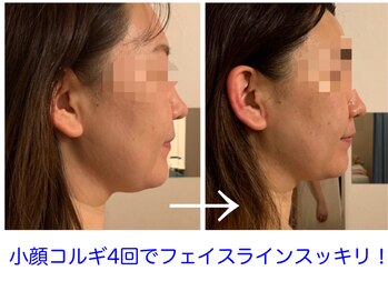 モテ肌 小顔コルギサロン カムトゥルー(come true)/小顔コルギの効果