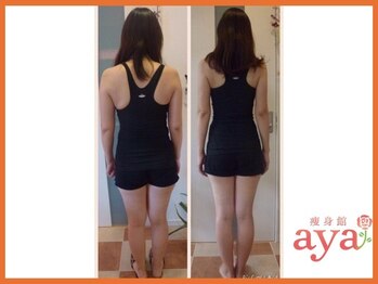 痩身館アヤ(aya)/耳つぼダイエット【富山/痩身】