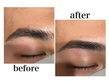 カイル 横浜(Kyle.)/メンズ脱毛&眉毛サロン 横浜ひげ