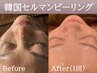 【乾燥/老化角質】韓国セルマンピーリング＋デコルテマッサージ付き（120分）