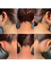 シュシュ 梅田店(+Chou chou)/うなじ脱毛