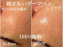 ユアン(YUAN)の雰囲気（肌管理/プラズマニア/シミケア/毛穴/リフトアップ/小顔/毛穴ケア）