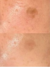 ラエッセ 目黒 白金台店(LAESSE)/毛穴・美白専門店 LAESSE 白金台