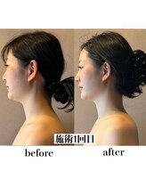 語 かたりべ/エステ　ビフォー・アフター