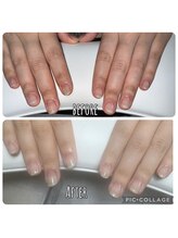 フィール 茂原店(Feel)/美爪矯正