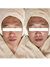 フェリノ(FERINO)/エンビロンでハリツヤ肌に♪♪