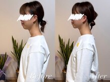 ハクト(Hakuto)/Before/After