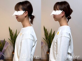 ハクト(Hakuto)/Before/After