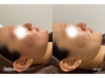 アネル 豊見城(anel)/