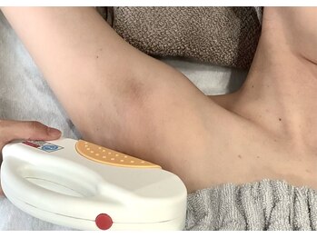 エナ(ENA)/【脱毛】一番人気箇所ワキ脱毛