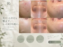 アール(R;)