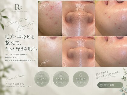 アール(R;)の写真