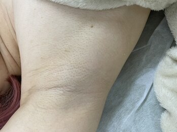 ナノハナ/鹿沼市の全身脱毛美容室ナノハナ