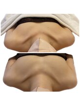 ルリリ(Luriri)/お胸ふっくらエステ