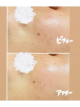 トラ(TORA)/ヒト幹細胞コース