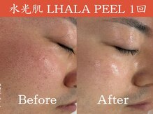 一期一会 恵比寿店(ichigo ichie)/ララピールbefore after 