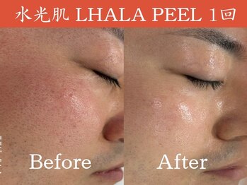 一期一会 恵比寿店(ichigo ichie)/ララピールbefore after