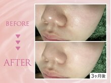 クリアラボ 錦糸町(Clear Lab)/韓国肌管理&毛穴洗浄専門店