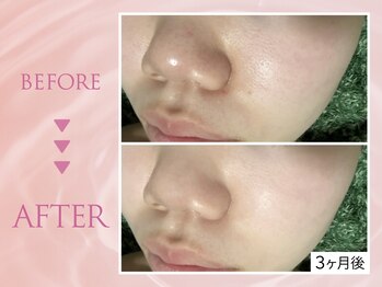 クリアラボ 錦糸町(Clear Lab)/韓国肌管理&毛穴洗浄専門店