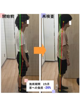 まつむらカイロプラクティック 新宿/【姿勢習慣化プログラム 】実例7