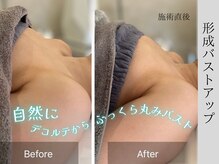 グロウ(glow.)/形成バストアップ