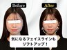 【小顔矯正×美容鍼】むくみ改善60分 12,100→初回7,000円