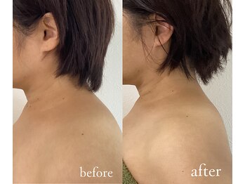 トリートメントルーム フェリーチェ(Felice)/たるみケアで体のもっさり感解消