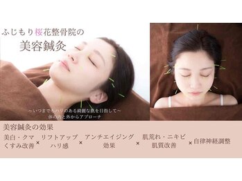 ふじもり桜花整骨院の写真/【初めての方にもおすすめの美容鍼◎】気になっていた方必見☆気になるお肌のお悩みにアプローチ！