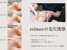 レイミー(reimee)/【毛穴洗浄】施術の様子・経過