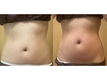 オプレア 千種店(OPREA)/比較写真