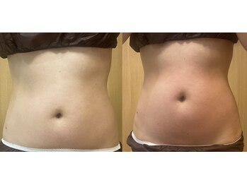 オプレア 千種店(OPREA)/比較写真