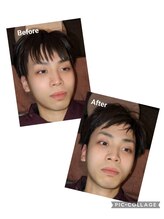 もみ処癒し屋 山口店/眼精疲労でビフォーアフター