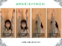 ボディ リセット アンド デザイン(Body Reset & Design)/【施術例】ビフォーアフター