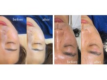 ペネロピ(Penelope)/ララピール