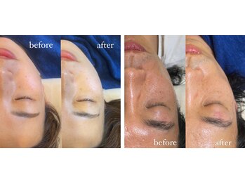 ペネロピ(Penelope)/ララピール