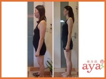 痩身館アヤ(aya)/耳つぼダイエット【富山/痩身】