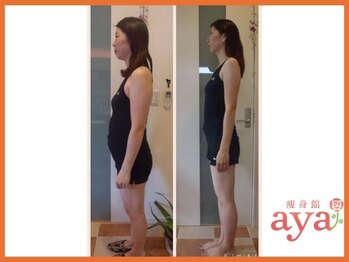 痩身館アヤ(aya)/耳つぼダイエット【富山/痩身】