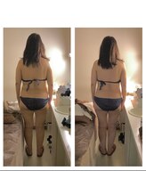 アクア エステティコ 亀有(ACQUA estetico)/中半身痩身　半年経過