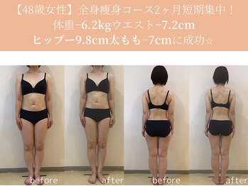 エターナルフレーム(Eternal Flame)/48歳痩身スリムビフォーアフター