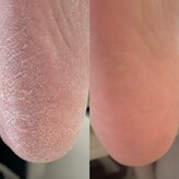 エマネイル(emma nail)