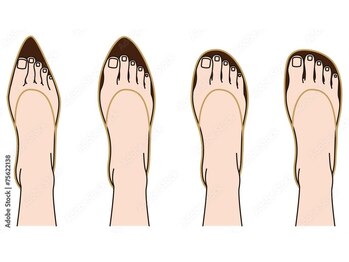 ネイルサロン チェリッシュ(Nailsalon Cherish)/巻き爪はお履き物の選定大事です