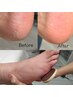 【フットケア人気！】足の爪＋足裏のお手入れ、しっとりつるすべ保湿セット