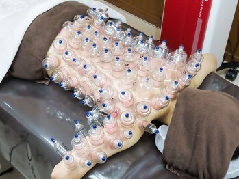 スロー(Slow)/疲労回復!本格韓国式カッピング